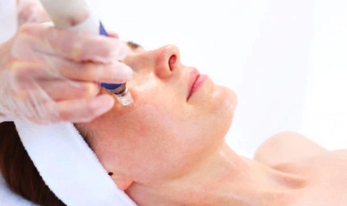 Microneedling cost in Vancouver