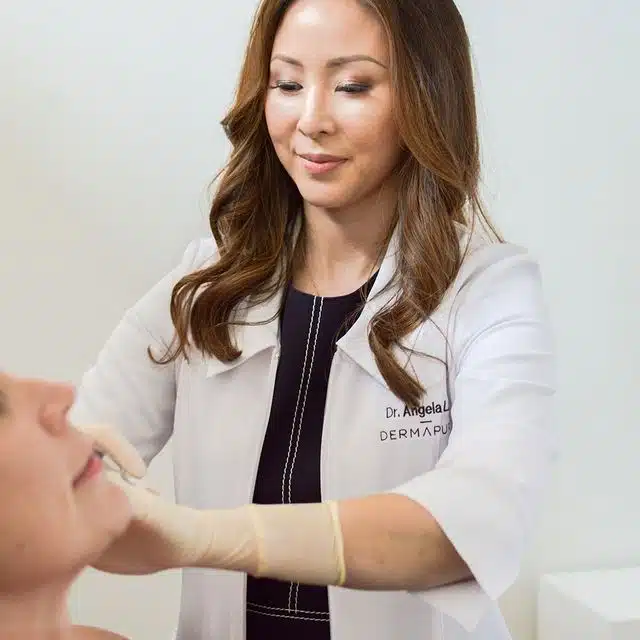 A dermapure physician treating a patient